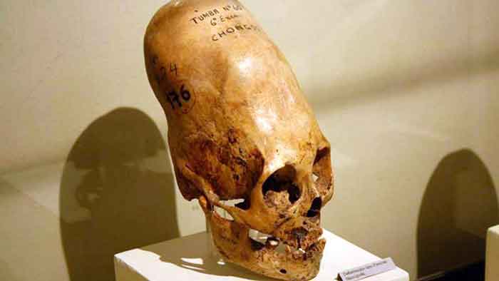 Imagen de una cabeza con deformacion craneana de la cultura paracas